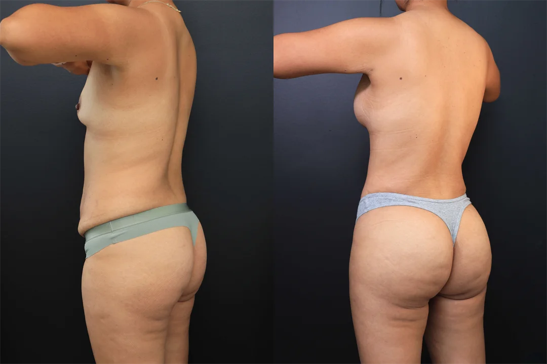 102301-Left Posterior Oblique combined
