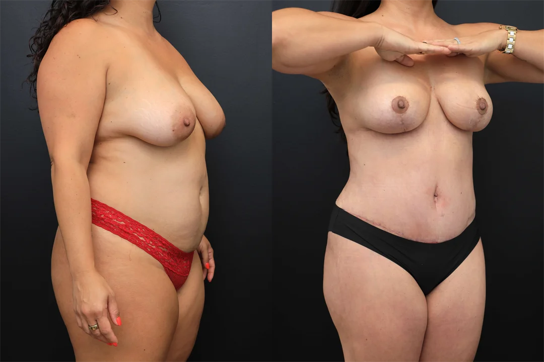 102315-Right Oblique combined