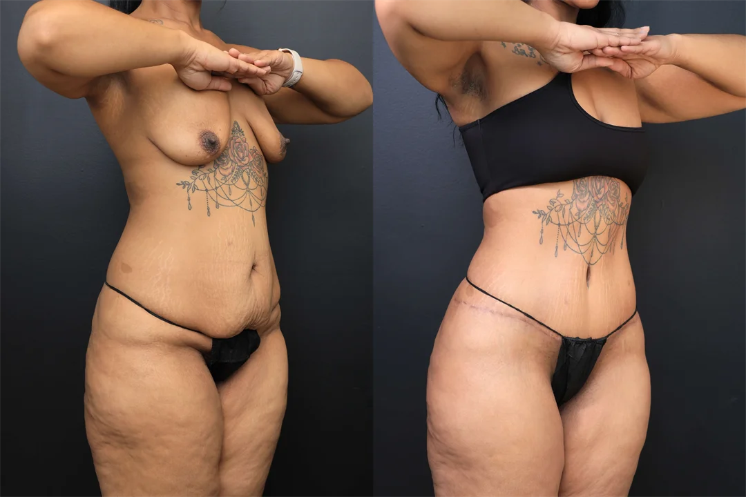 102366-Right Oblique combined
