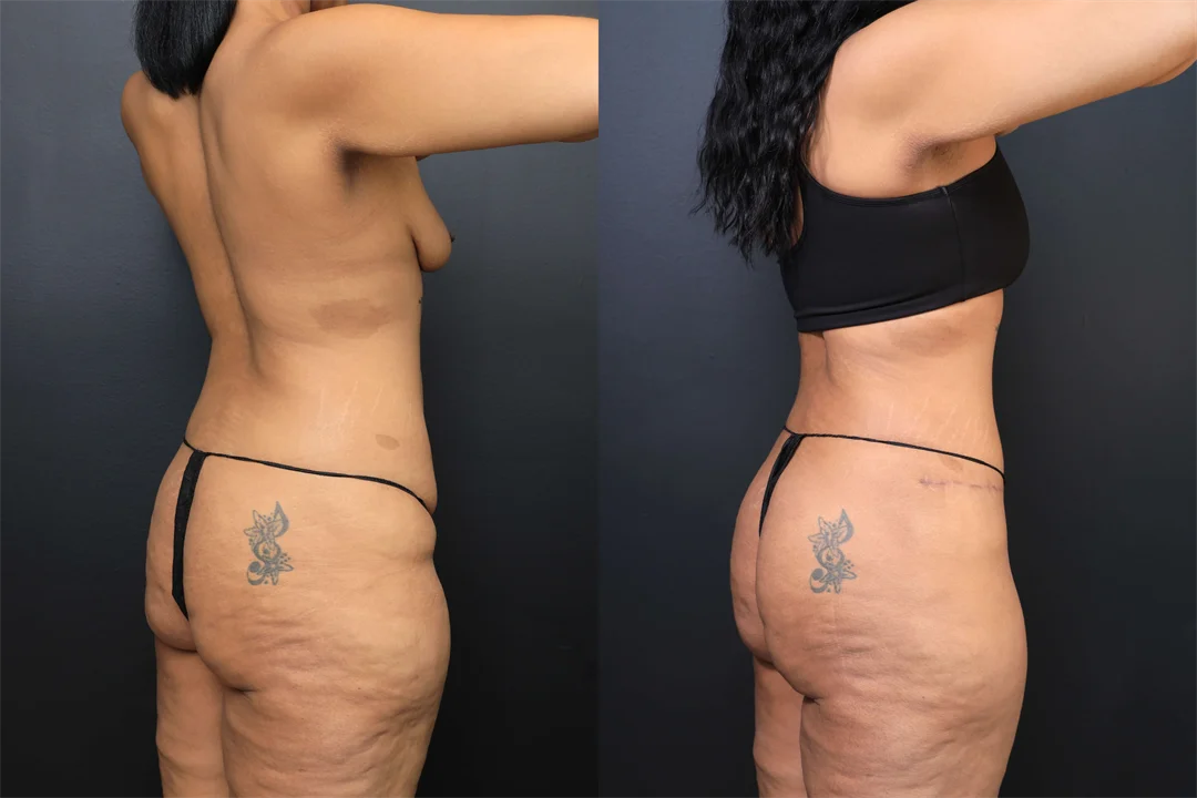 102366-Right Posterior Oblique combined