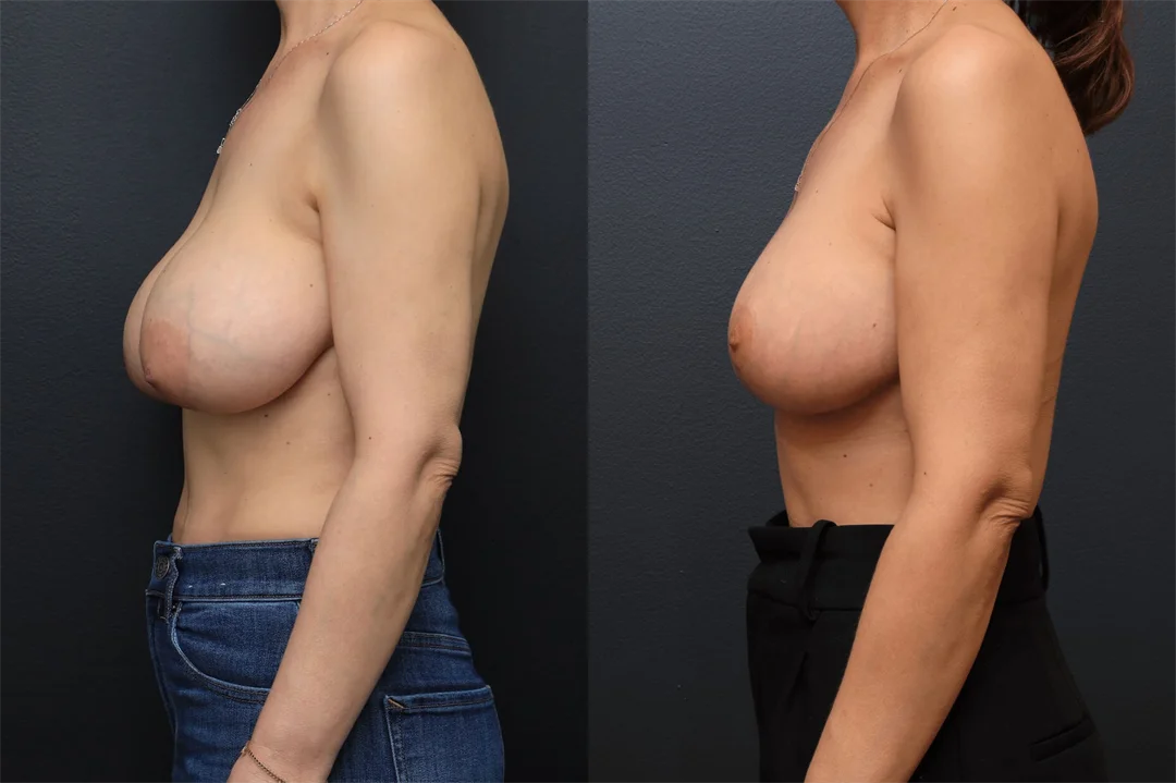 102895-Left Lateral combined