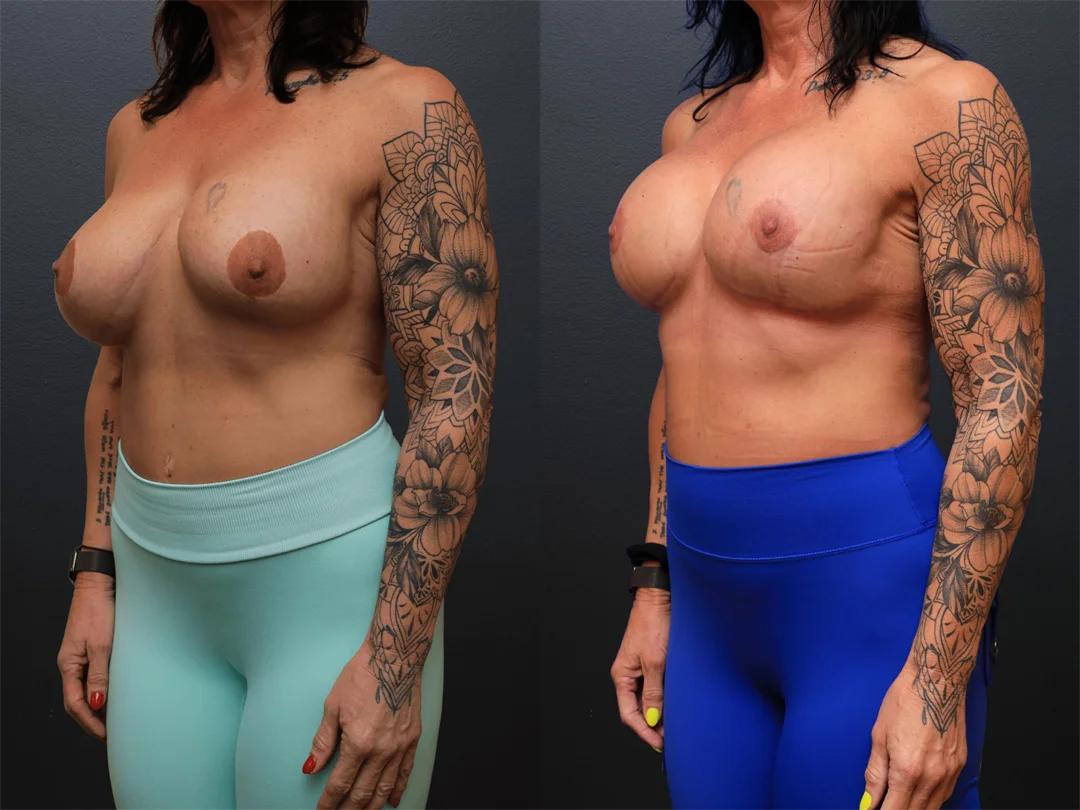 105358-Left Oblique combined