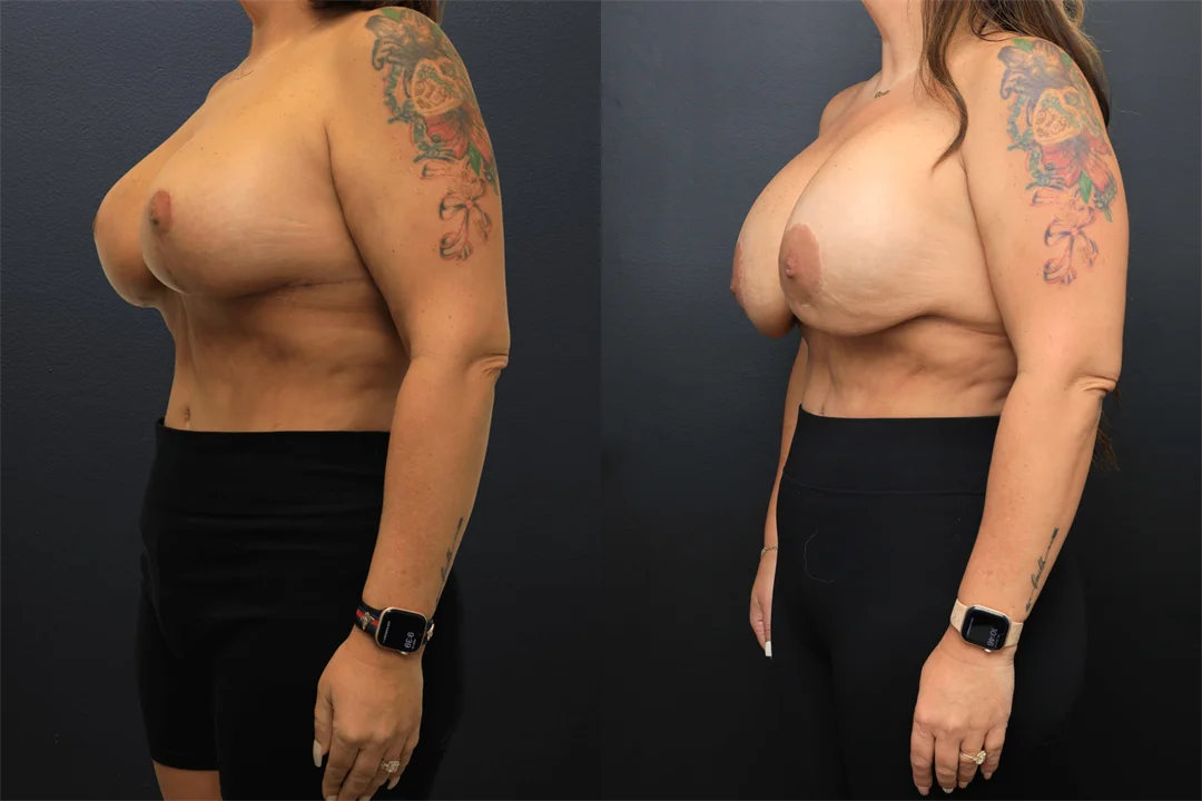 108666-Left Oblique combined