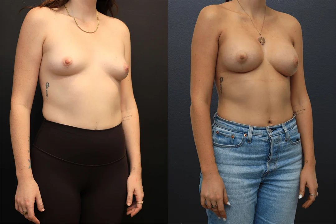 108762-Right Oblique combined