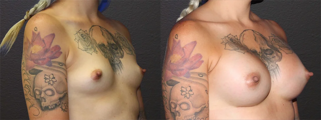 66579-RIGHT OBLIQUE combined