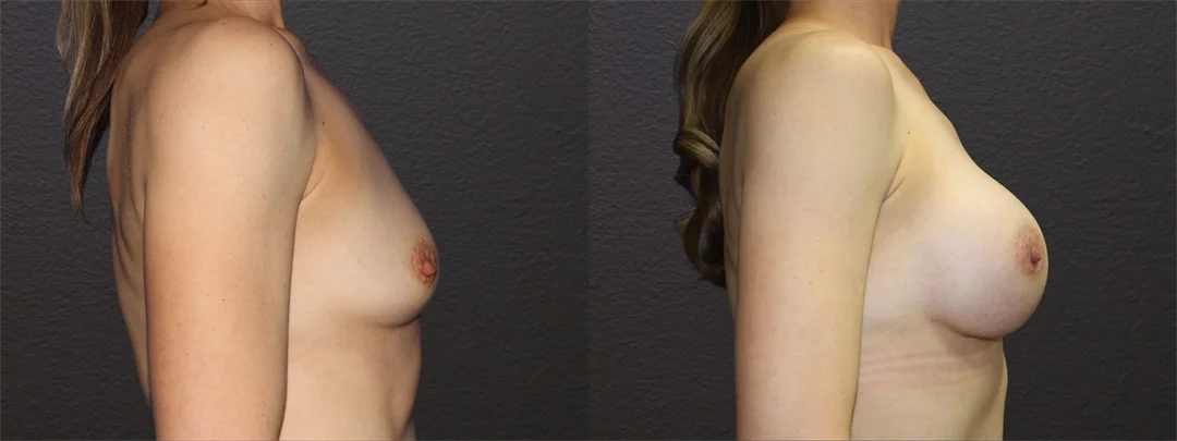 66585-RIGHT LATERAL combined