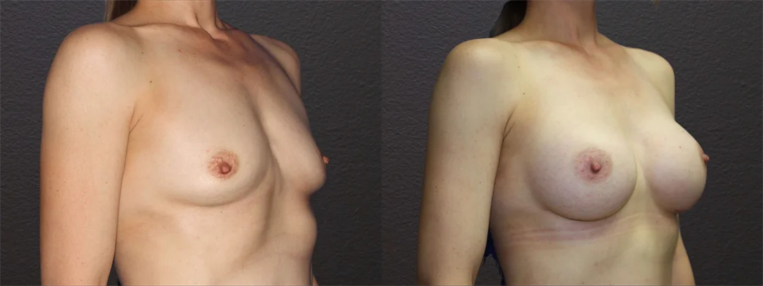 66585-RIGHT OBLIQUE combined