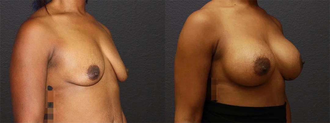 66611-RIGHT OBLIQUE combined