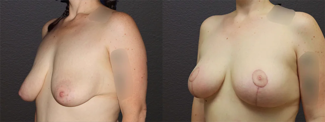 66748-LEFT OBLIQUE combined