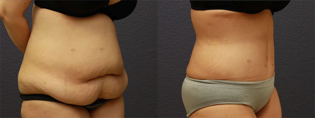 66815-RIGHT OBLIQUE Before