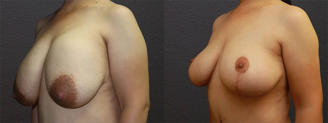 66846-LEFT OBLIQUE combined