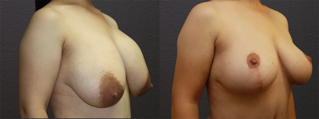 66846-RIGHT OBLIQUE combined