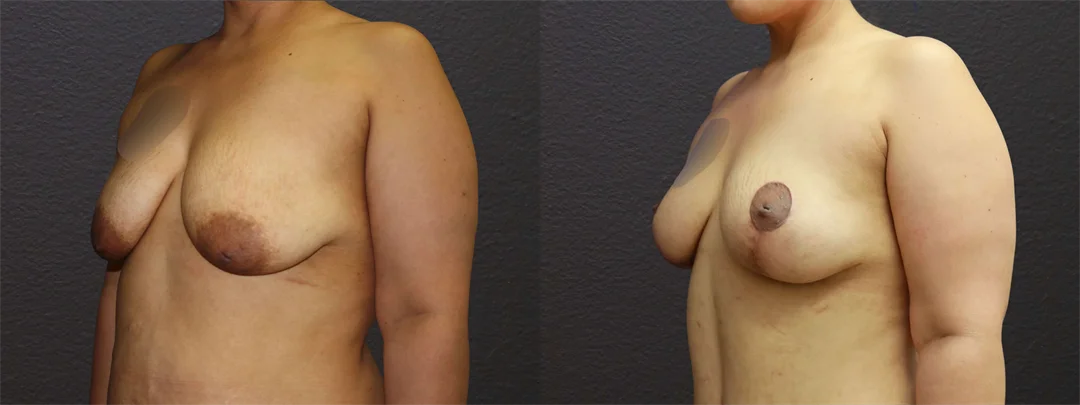 66847-LEFT OBLIQUE combined
