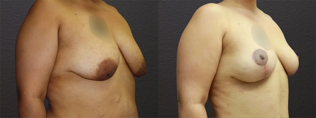 66847-RIGHT OBLIQUE combined