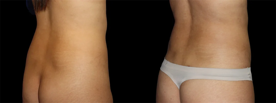 67170-Right back oblique combined