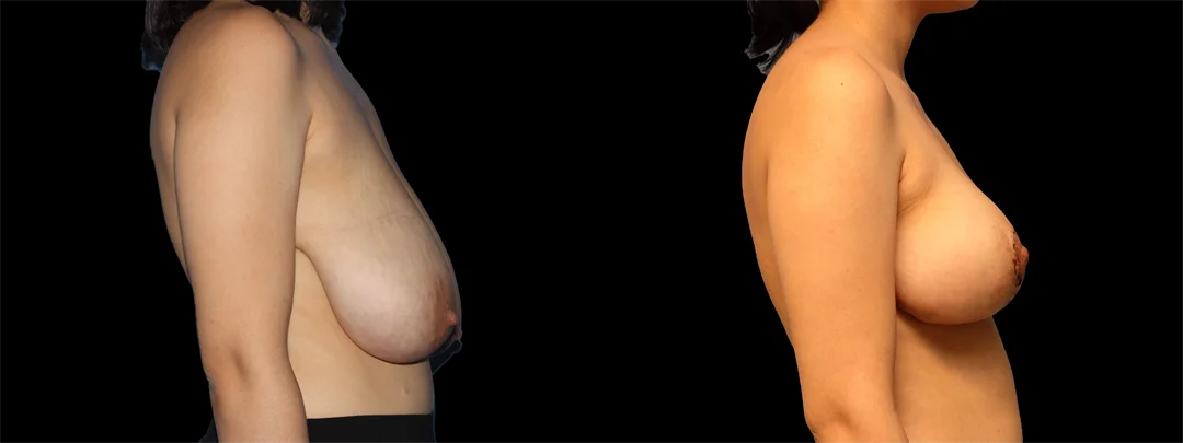67180-RIGHT LATERAL combined