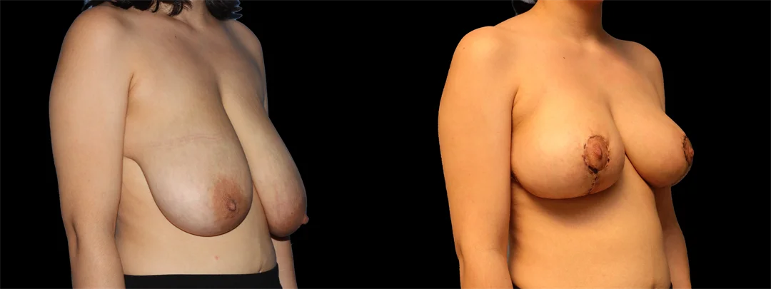 67180-RIGHT OBLIQUE combined