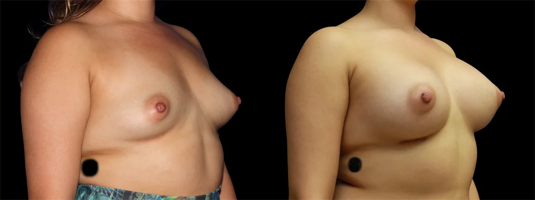 67189-RIGHT OBLIQUE combined