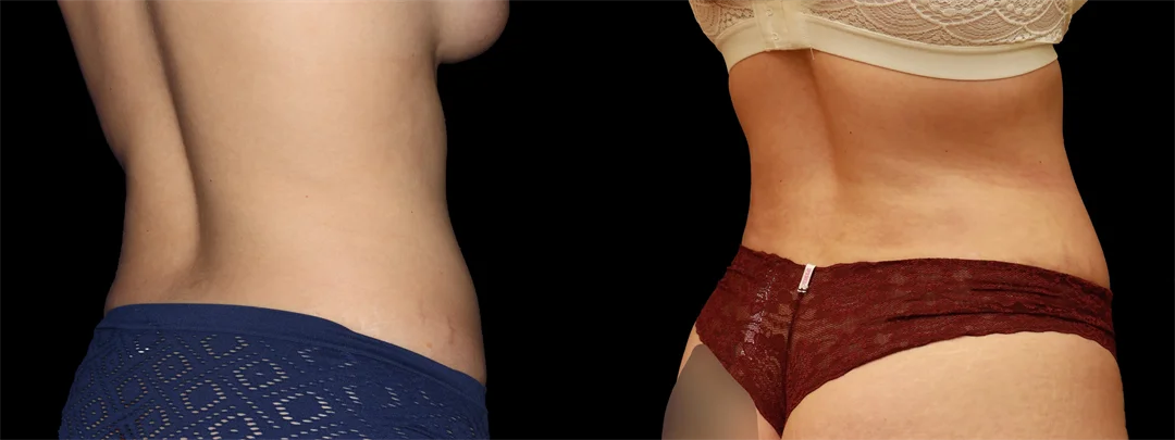 67191-Right back oblique combined