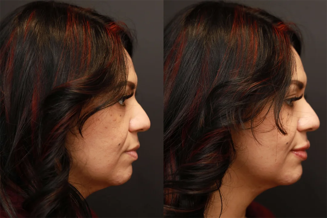 67690-Right Lateral combined