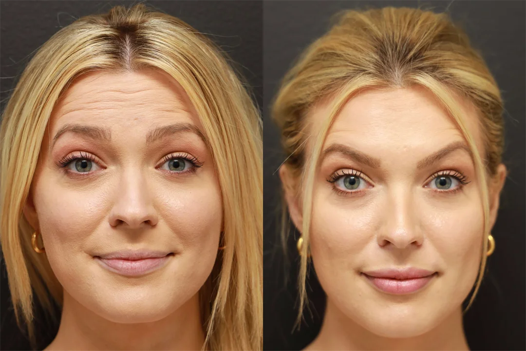 68734-EYEBROWS RAISED combined
