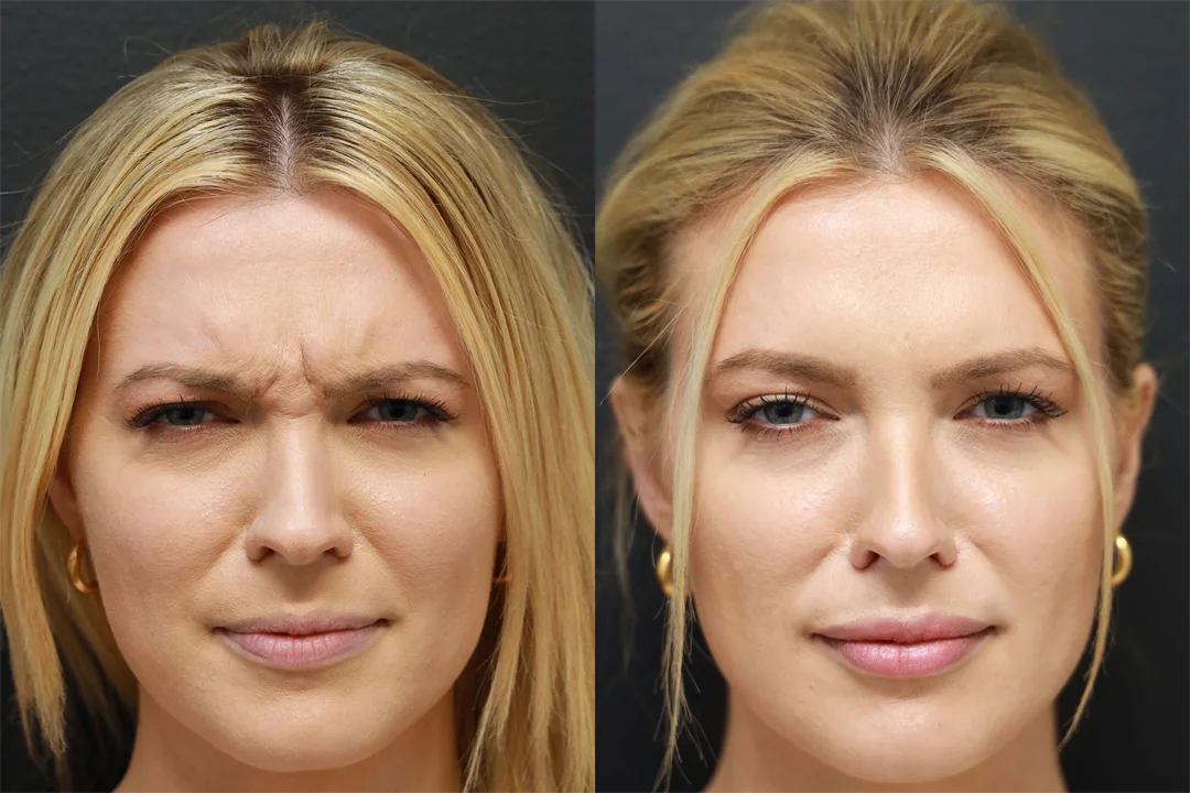 68734-FROWNING combined