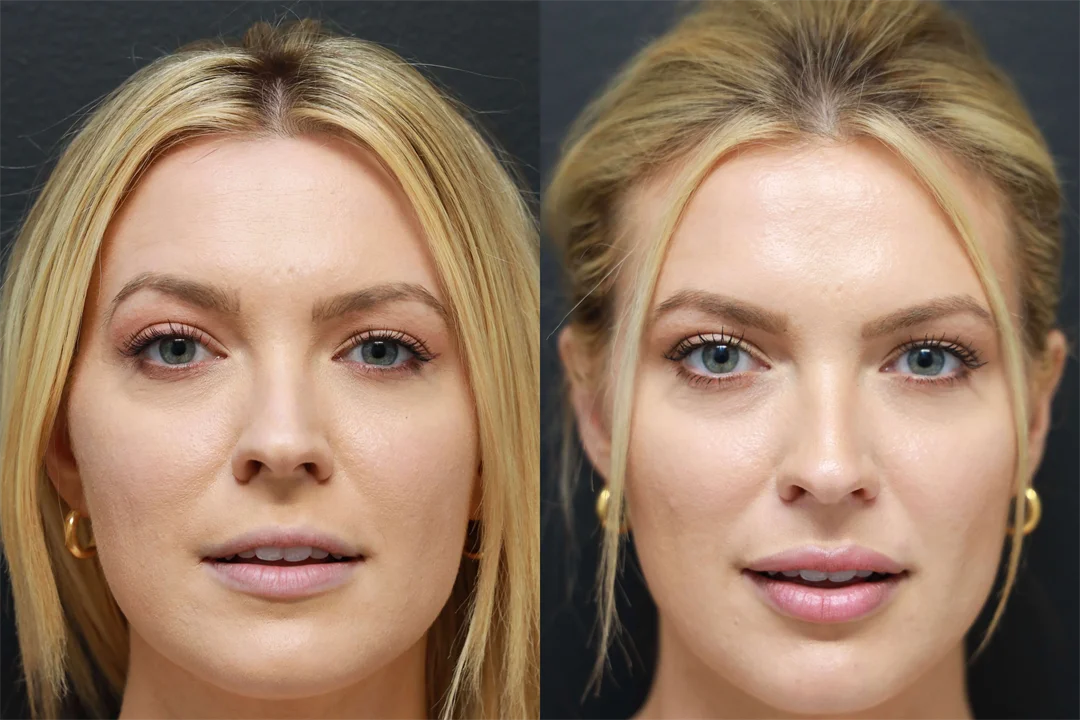 68734-LIPS PARTED combined