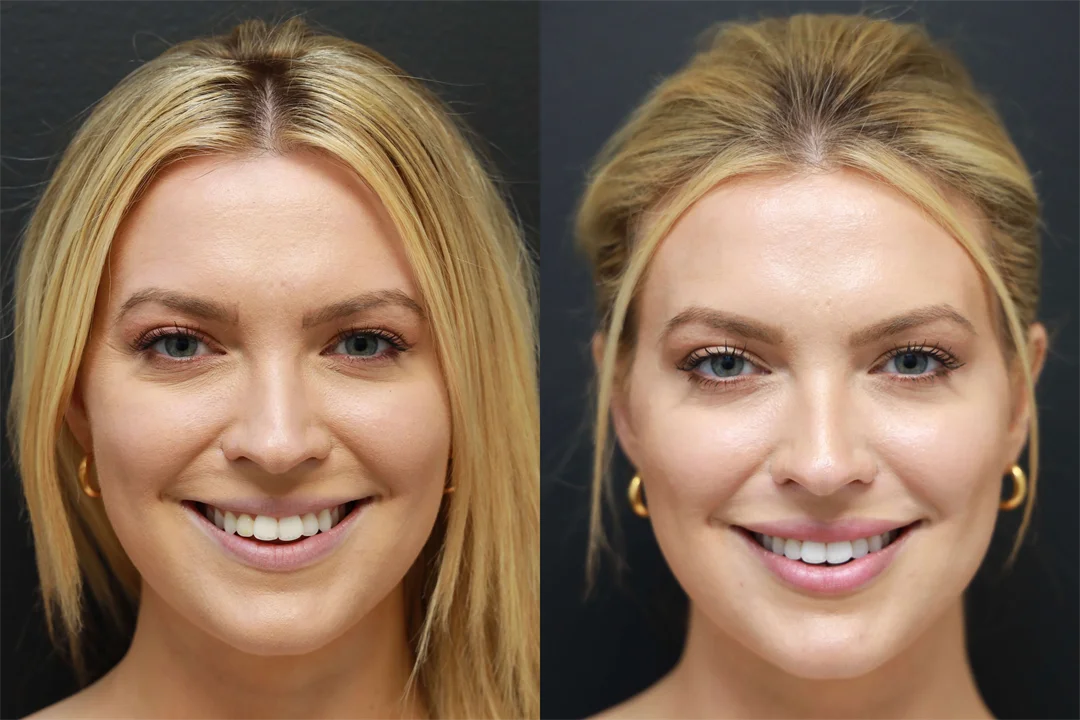 68734-SMILING combined
