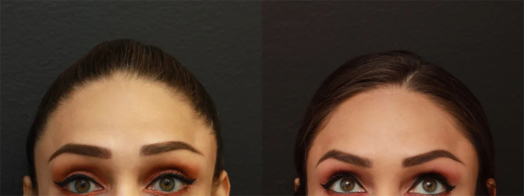 70436-AP Eyebrows Raised combined