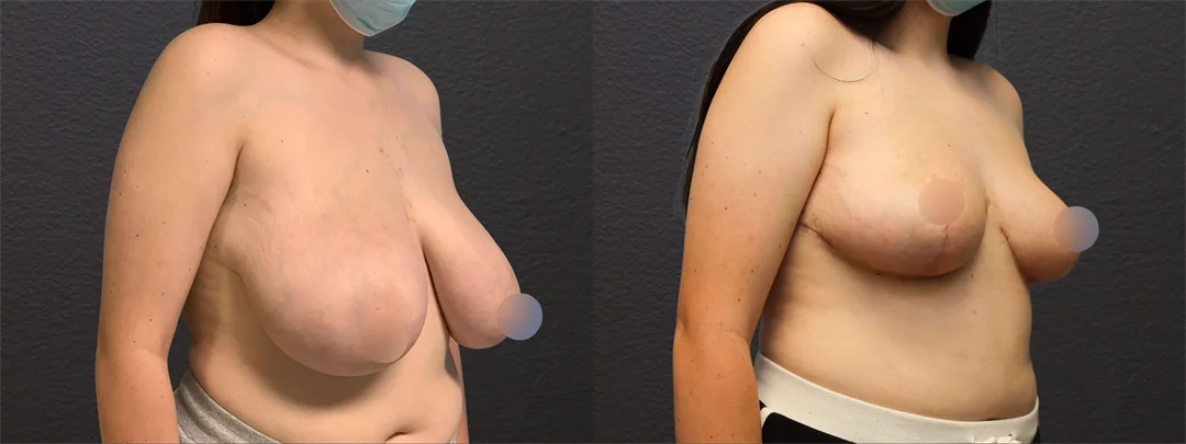 71061-RIGHT OBLIQUE combined