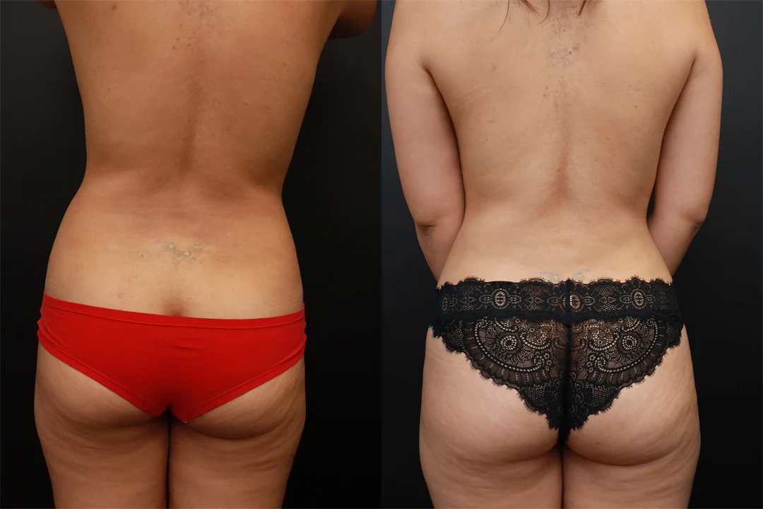 73454-Posterior combined
