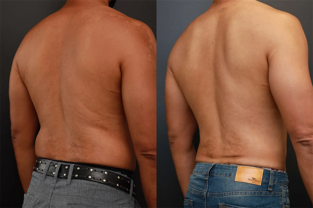 76130-Right Back Oblique combined