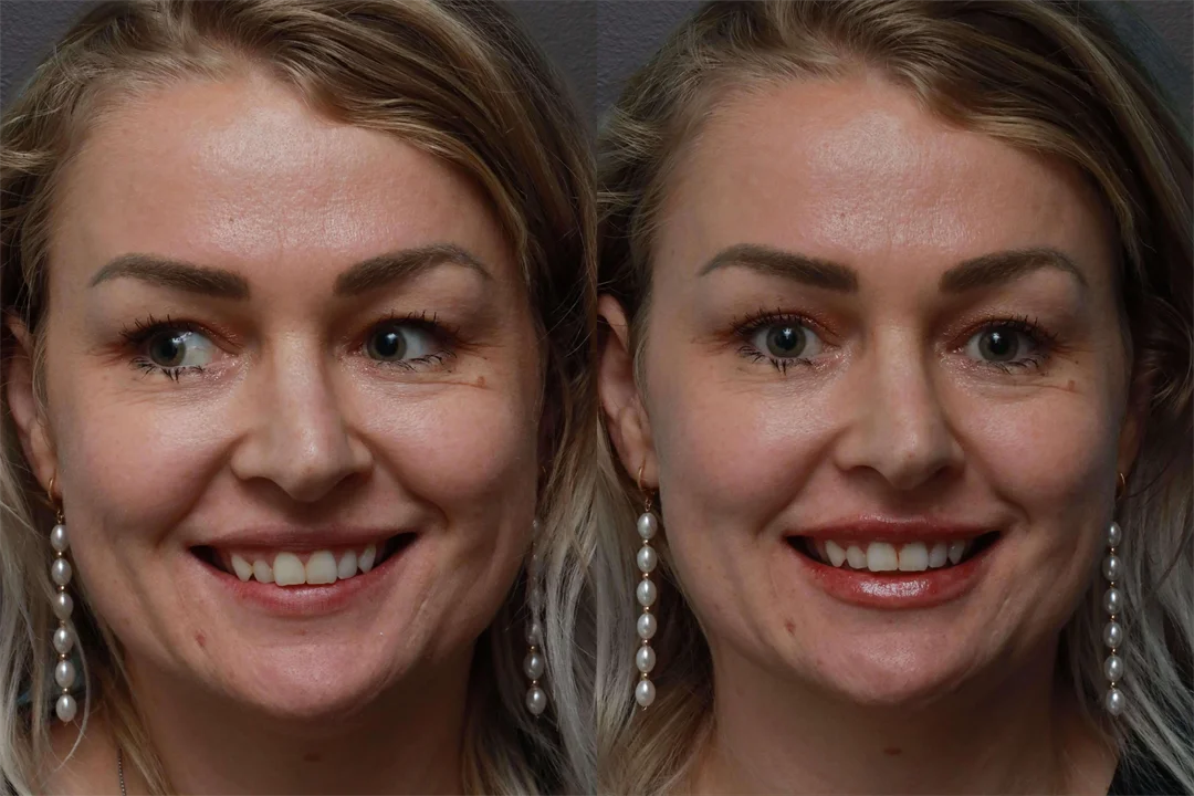 76333-AP Smiling combined