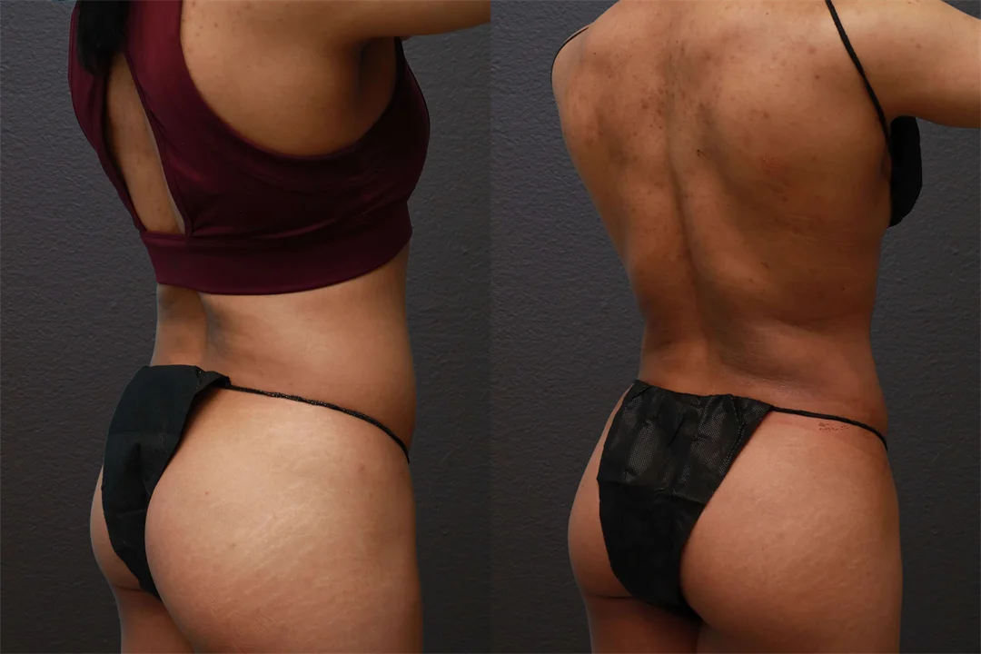 76570-Right Back Oblique combined