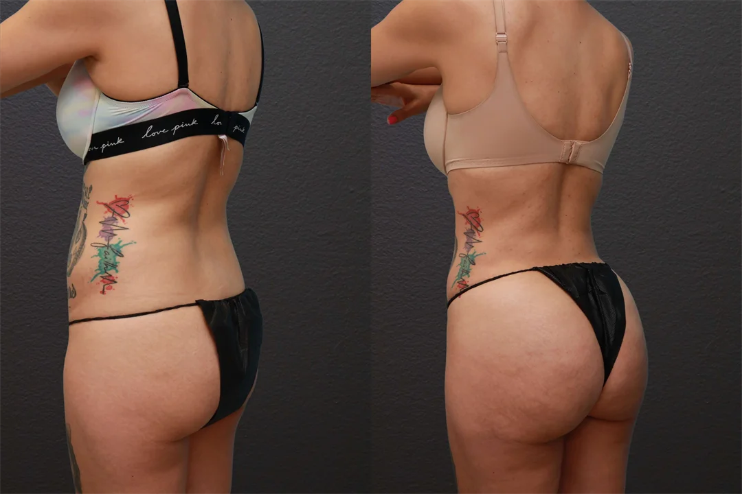 78155-Left Back Oblique combined