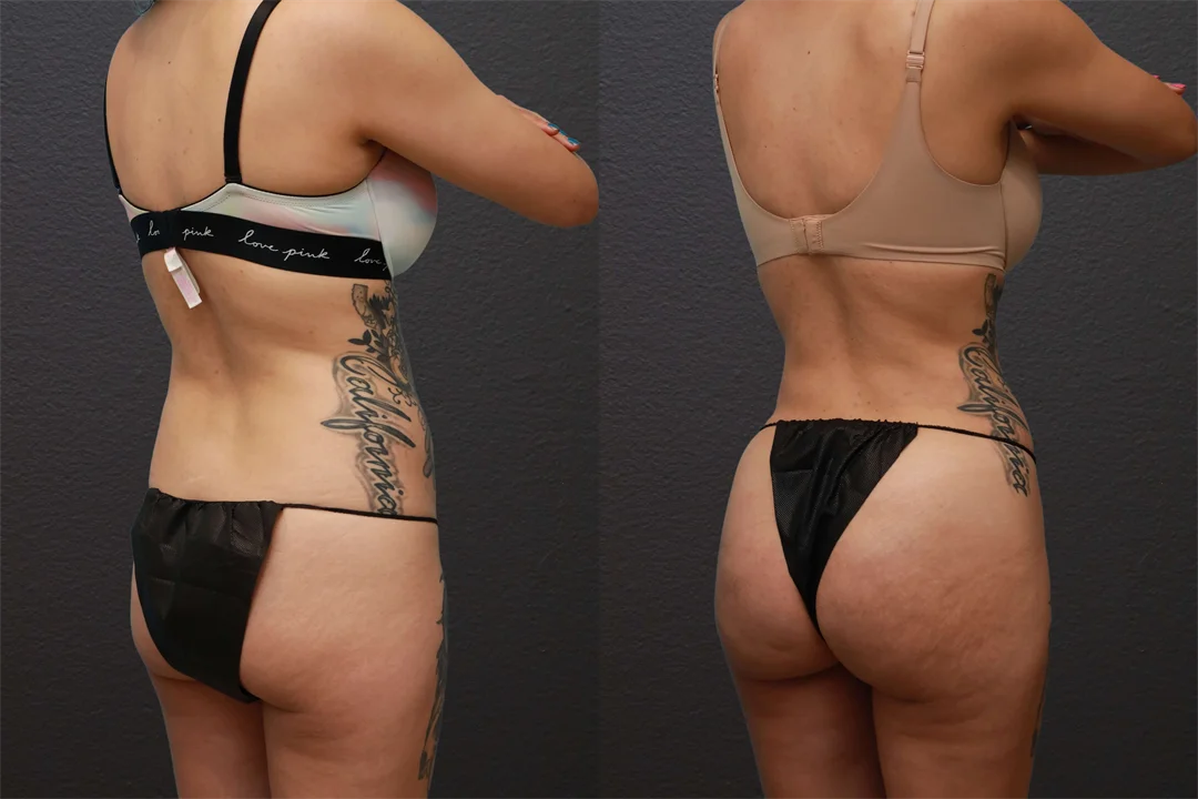 78155-Right Back Oblique combined