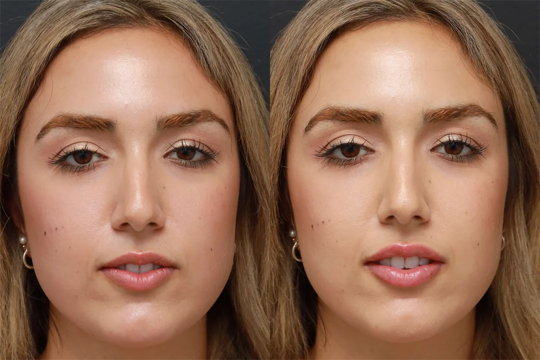 78979-AP Lips Parted combined
