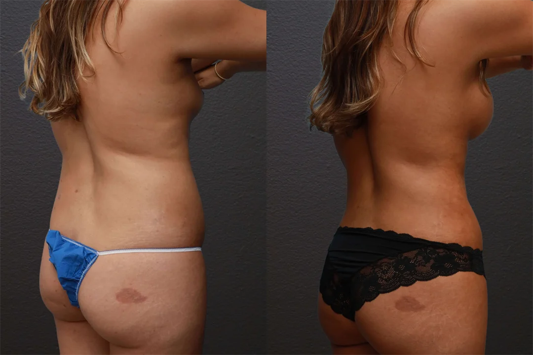 79137-Right Back Oblique combined