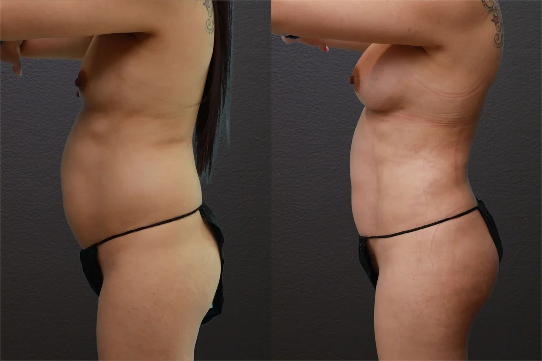 80553-Left Lateral Arms Up combined