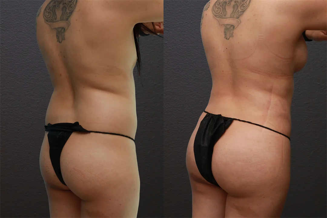 80553-Right Back Oblique combined