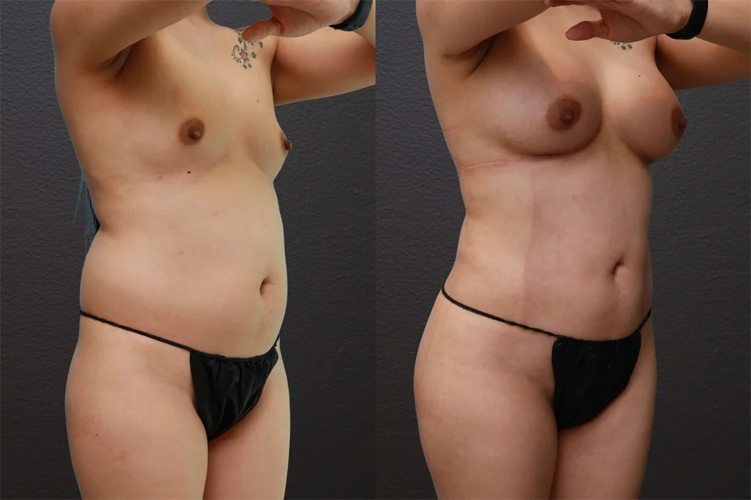 80553-Right Oblique Arms Up combined