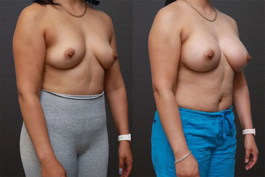 80843-Right Oblique combined