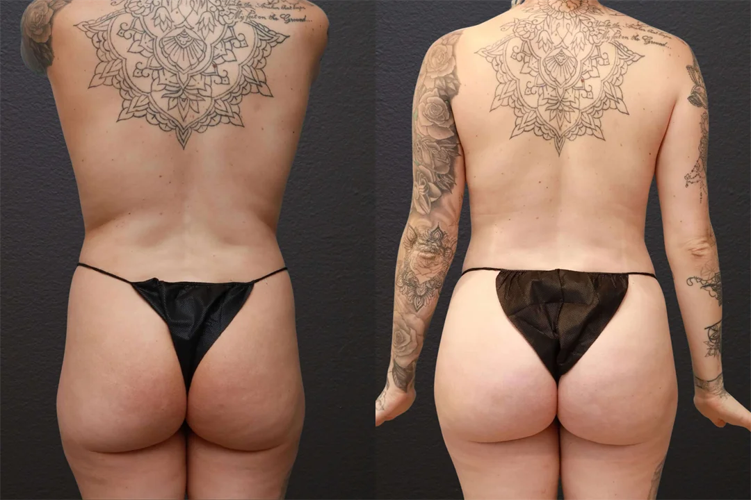 81611-AP combined