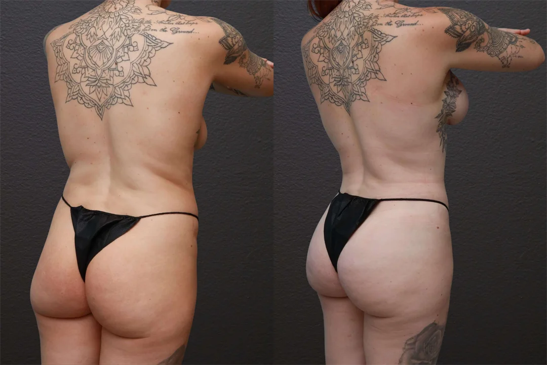 81611-Right Back Oblique combined