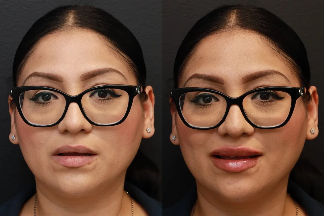 81658-AP Lips Parted combined