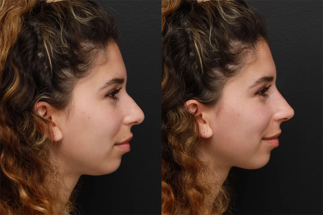82636-Right Lateral combined