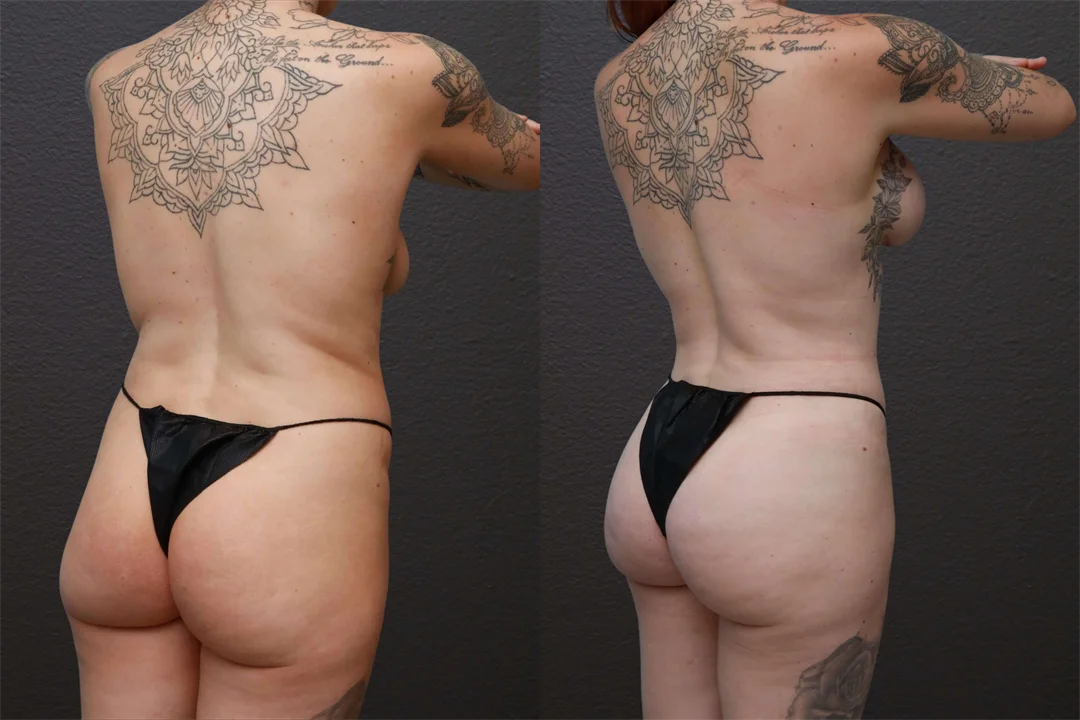 83301-Right Oblique combined