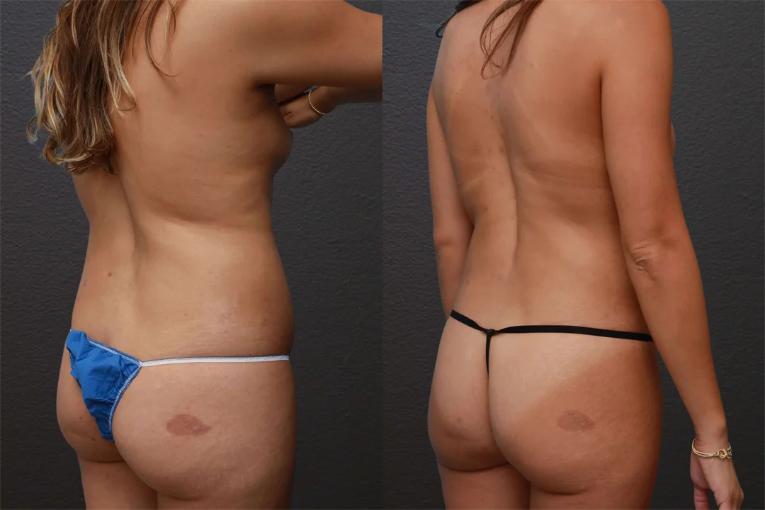 84888-Right Back Oblique combined