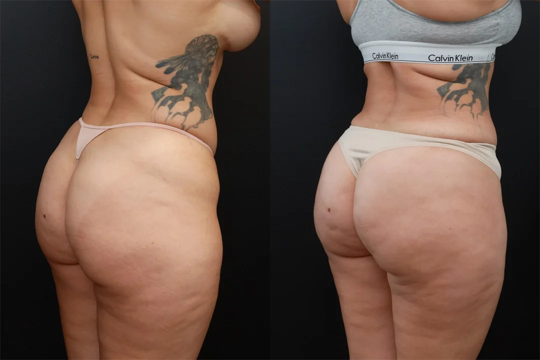 85091-Right Back Oblique combined