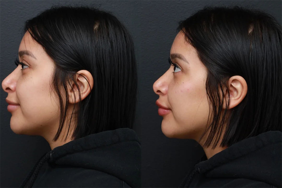 85779-Left Lateral combined
